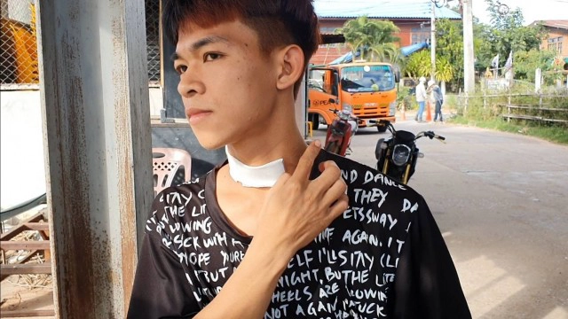 หนุ่มขี่ จยย.ถูกเชือกว่าวขวางถนนบาดคอ