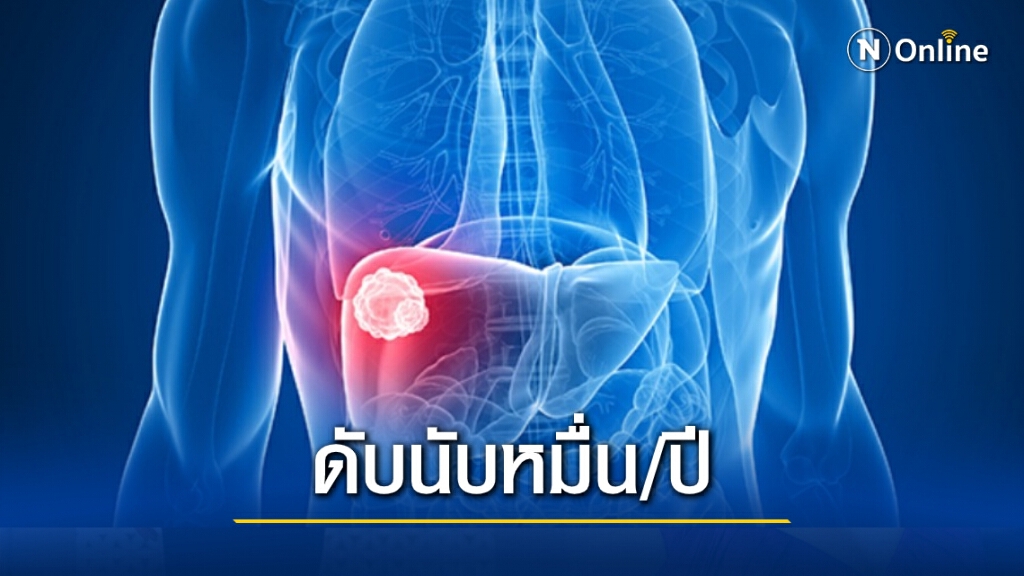 รู้หรือไม่..."มะเร็งตับ"พบมากเป็นอันดับ 1 ของคนไทย รู้หรือไม่..."มะเร็งตับ"พบมากเป็นอันดับ 1 ของคนไทย