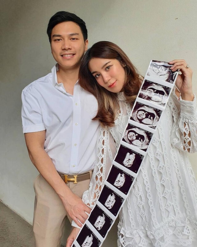 "ขนมจีน" แจ้งข่าวดี ตั้งท้องลูกคนแรก ดีใจมากที่สุด พร้อมเผยภาพอัลตราซาวด์!!