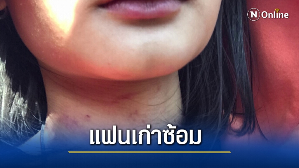 นศ.สาวไลฟ์สดขอความช่วยเหลือ ถูกลูกตร.แฟนเก่าซ้อม