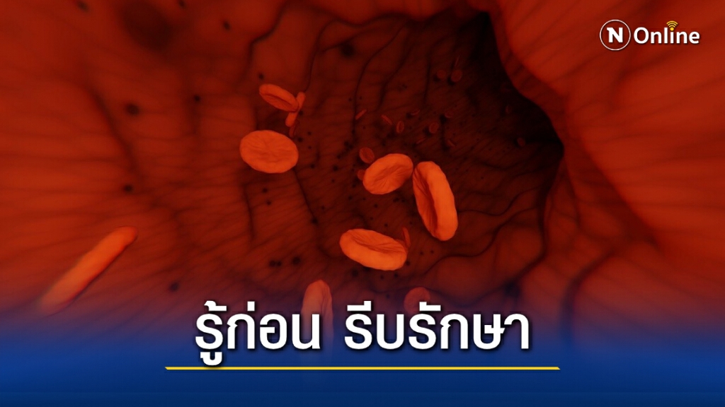 รู้จักโรค ITP เกล็ดเลือดต่ำในเด็ก รู้จักโรค ITP เกล็ดเลือดต่ำในเด็ก