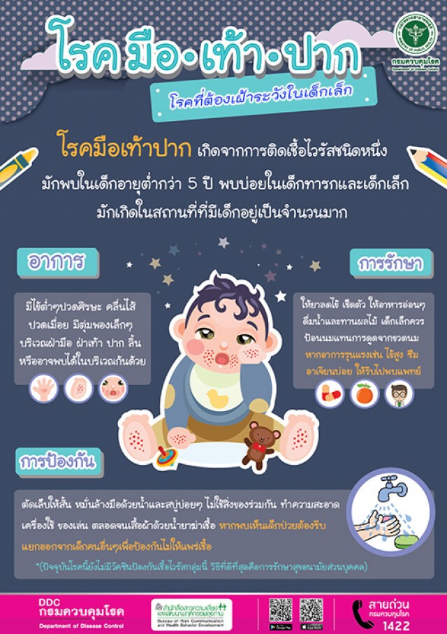 แพทย์เตือน เปิดเทอมระวังเด็กป่วย"โรคมือ เท้า ปาก" เผยยอดป่วยพุ่งสูง