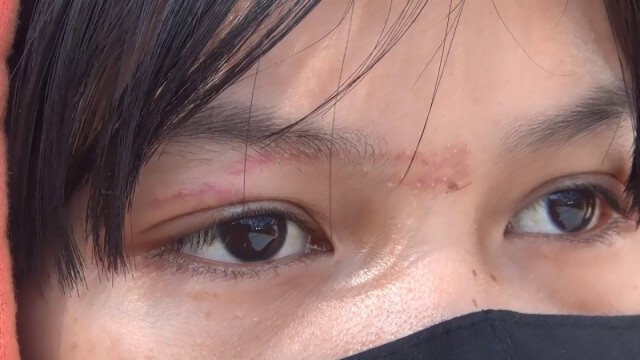 ครอบครัวนศ.สาวถูกแฟนเก่าซ้อมเตรียมแจ้งความเอาผิดแน่
