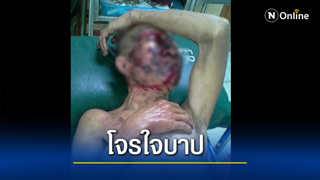 โจรใจบาปทุบหลวงตาวัย 66 จมกองเลือดเจ็บสาหัสเย็บ30เข็ม