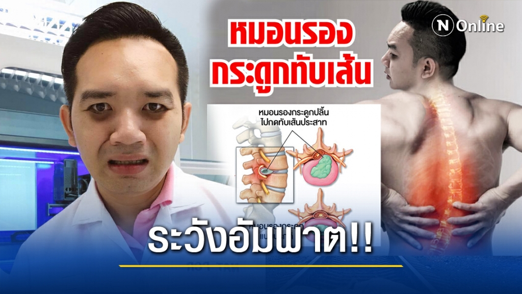 "หมอแล็บ"เตือน 'หมอนรองกระดูกทับเส้น' ไม่ควรนิ่งนอนใจ "หมอแล็บ"เตือน 'หมอนรองกระดูกทับเส้น' ไม่ควรนิ่งนอนใจ