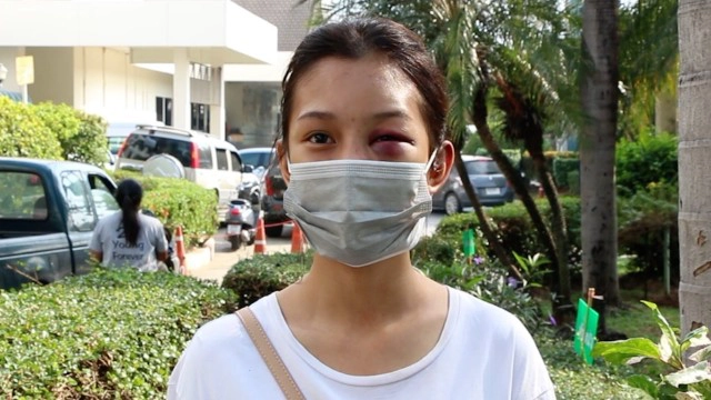 สาวพีอาร์ถูกนายทุนเงินกู้ใช้ปืนบีบีกันทำร้ายบาดเจ็บ