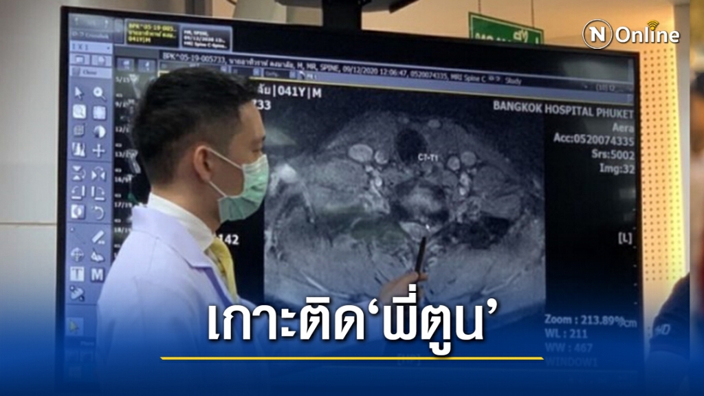 ทีมแพทย์ รพ.พระมงกุฎ เผยไทม์ไลน์อาการป่วย "พี่ตูน บอดี้สแลม"