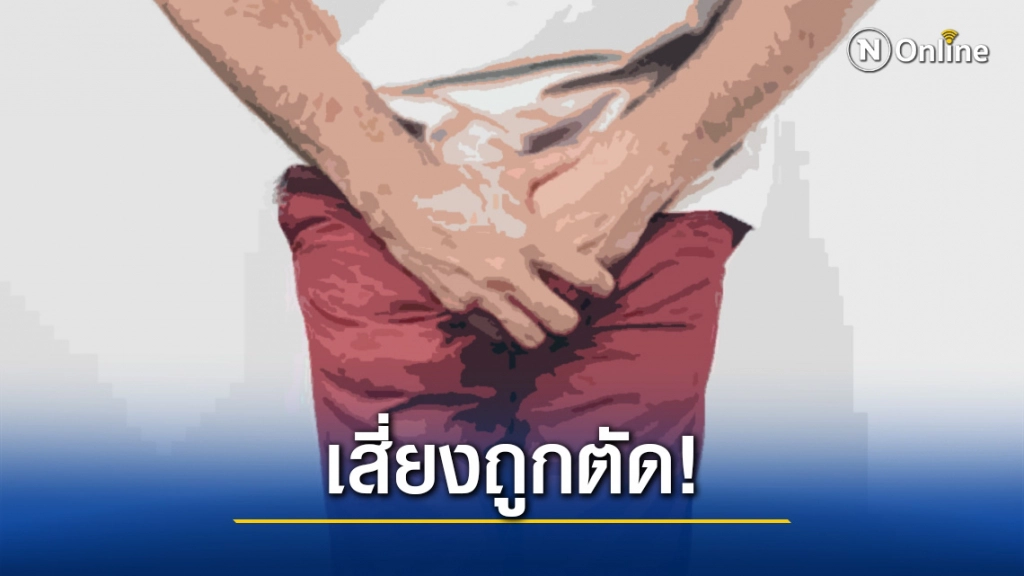 "อัณฑะบิดตัว" ภัยร้าย! ที่ผู้ชายควรรู้ รักษาไม่ทันเสี่ยงถูกตัด!