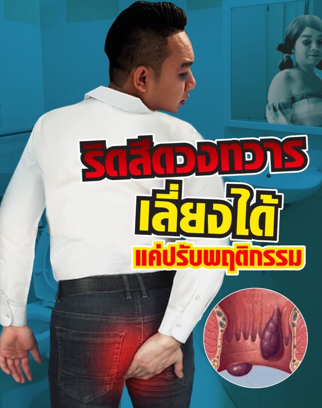 "ริดสีดวงทวาร" เลี่ยงได้ แค่ปรับพฤติกรรมการใช้ชีวิต