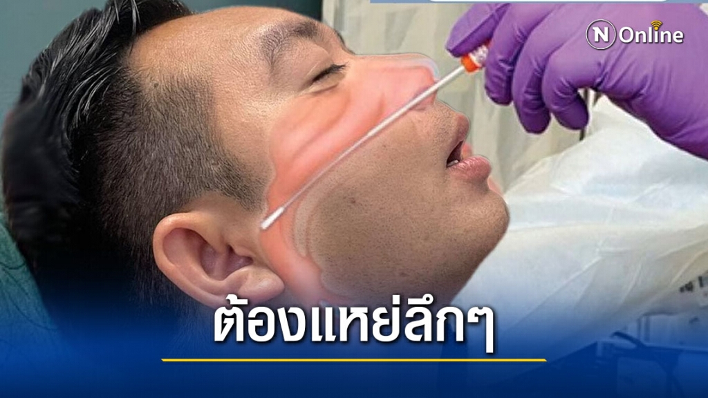 "หมอแล็บ" แจงหลังมีคนโวยไปตรวจโควิดถูกแหย่จมูกลึกเกินไป "หมอแล็บ" แจงหลังมีคนโวยไปตรวจโควิดถูกแหย่จมูกลึกเกินไป