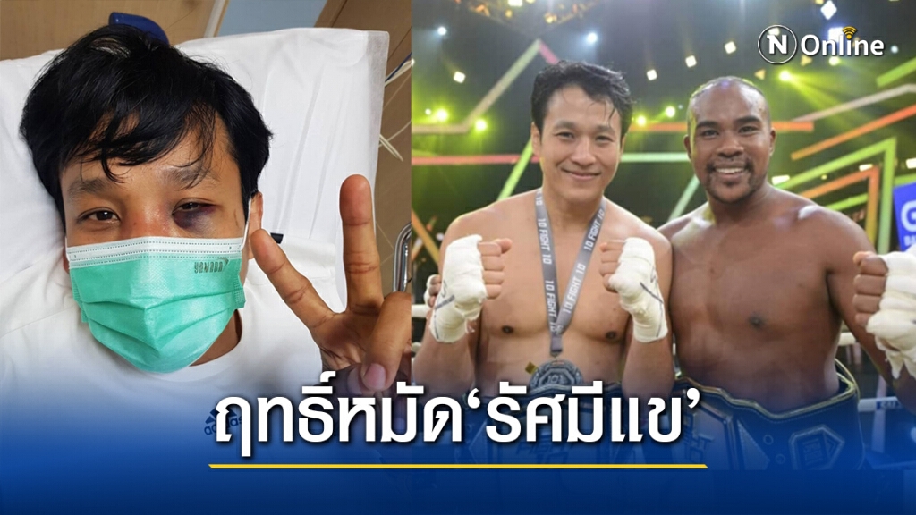 "เอ็กซ์ ธิตินันท์" เจ็บหนัก! ดวงตาฟกเขียวคล้ำ จนแฟนคลับเป็นห่วง หลังเจอพลังหมัด "รัศมีแข"