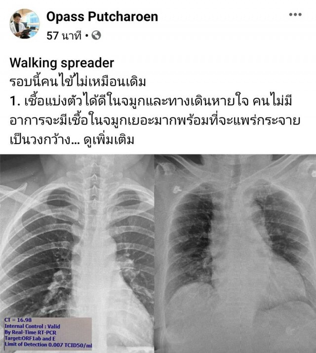 แพทย์ ชี้ อาการผู้ป่วยโควิด-19รอบนี้ไม่เหมือนเดิม