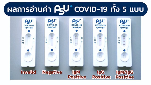 ม.อ. เปิดตัวชุดตรวจโควิด19 รู้ผลใน 15 นาที