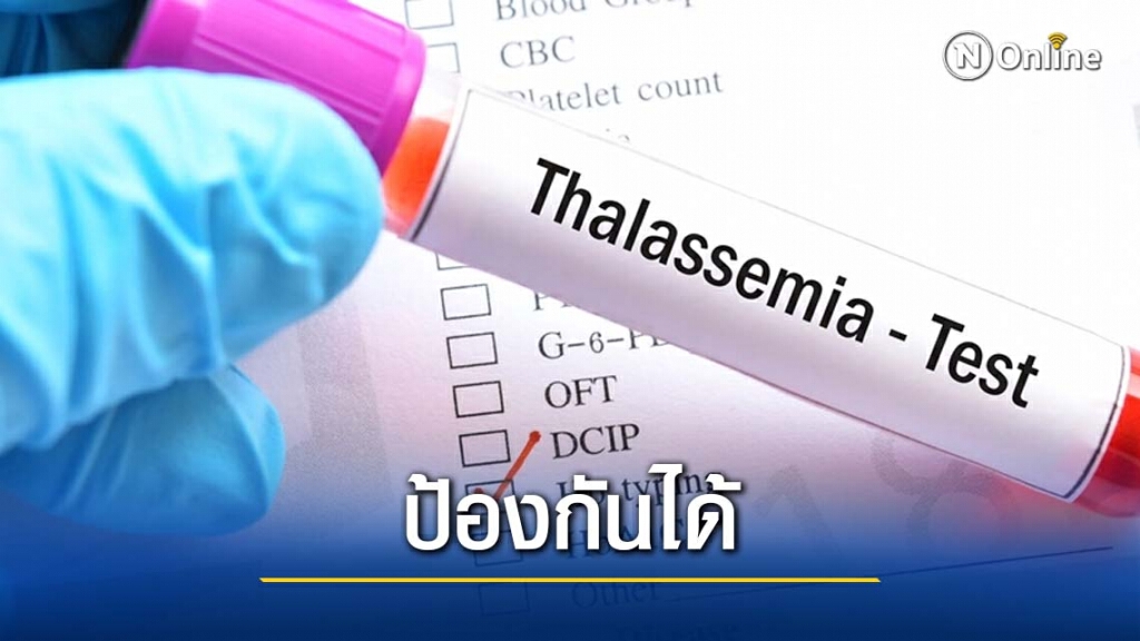 "ทาลัสซีเมีย"...โรคพันธุกรรมที่สามารถป้องกันได้ "ทาลัสซีเมีย"...โรคพันธุกรรมที่สามารถป้องกันได้