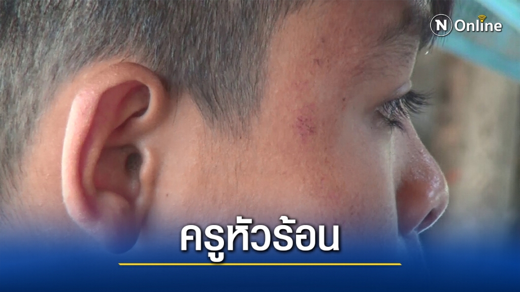 ครูหัวร้อนฉุนลูกศิษย์ ม.1 เหยียบเท้าตามชกจนน่วม