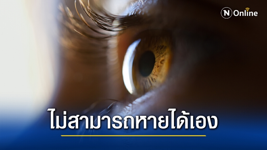 ตาเข ตาเหล่ในเด็ก รู้ก่อนรักษาหายได้