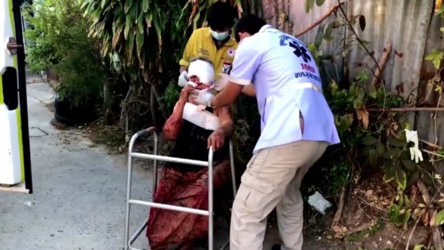 ลูกชายป่วยจิตใช้มีดปลอกผลไม้ฟันนแม่แผลทั่วตัว