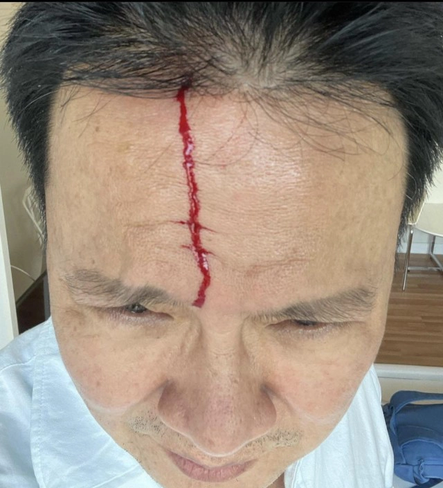 "จาตุรงค์" ตลกชื่อดังชนขอบประตูเลือดอาบ ส่งข่าวให้เพื่อนทราบแต่สิ่งที่ได้รับกลับฮาสนั่นโซเชียล!