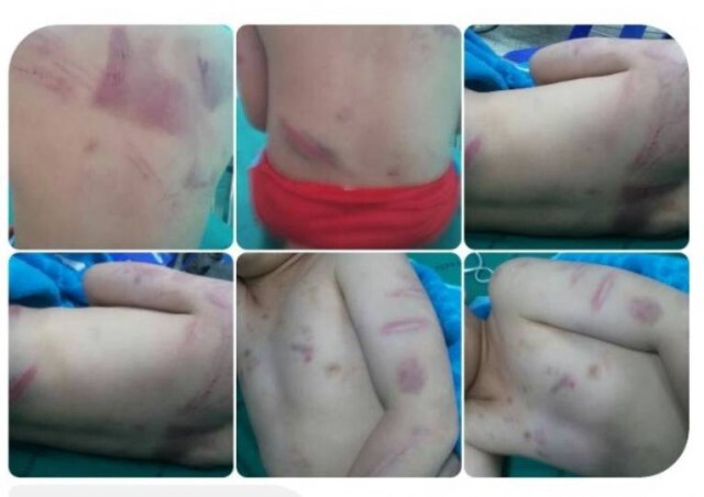 แจ้งข้อหาหนักแม่ทำร้ายลูกชายวัย 7 ขวบ
