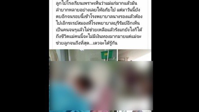 โพสต์โวยครูตบหน้าลูก 7 ขวบจนต้องเข้า รพ.