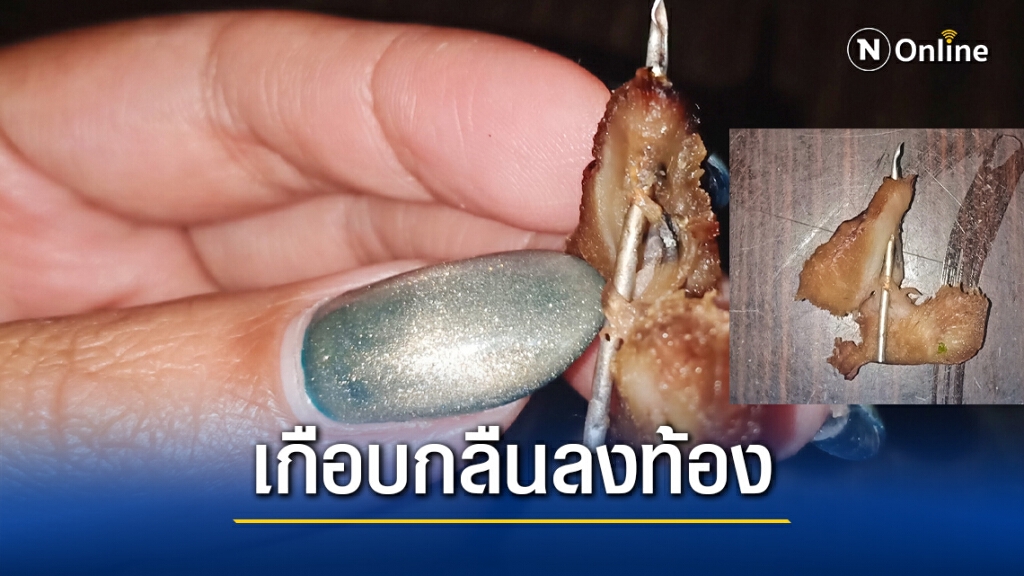 ผงะ! เคี้ยวเกือบกลืนเข็มในเนื้อหมู ผงะ! เคี้ยวเกือบกลืนเข็มในเนื้อหมู