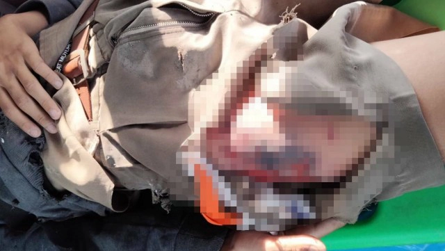 2เด็กชายแอบเล่นประทัดในรร.แตกใส่หว่างขา หวิดจู๋กระจุย