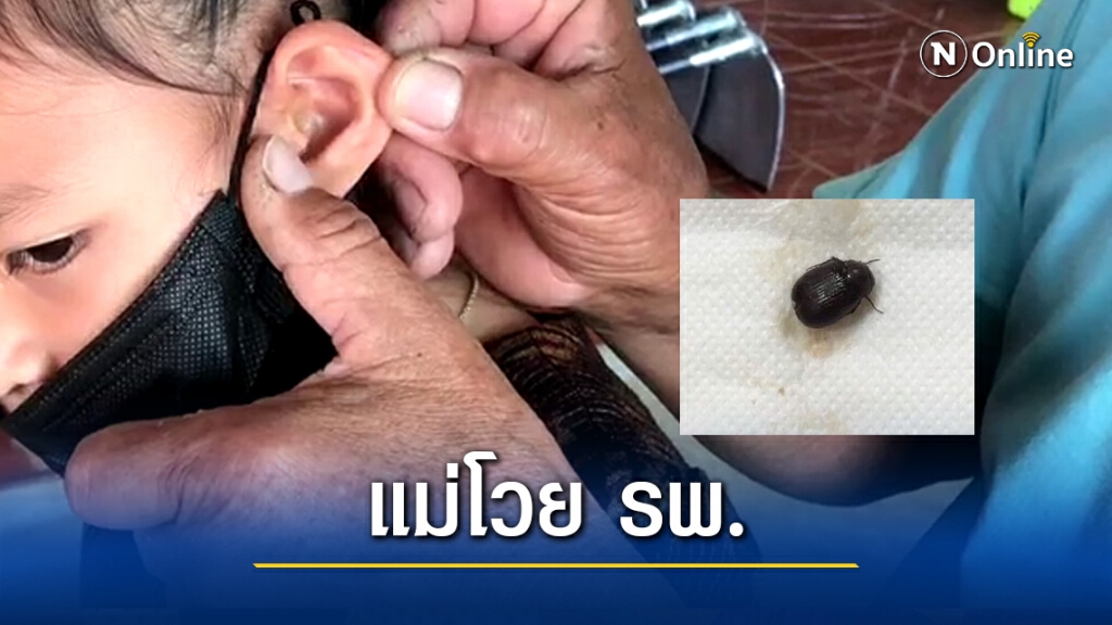 โวย รพ.ไม่มีหมอเวรรักษาลูกสาวแมลงเข้าหู