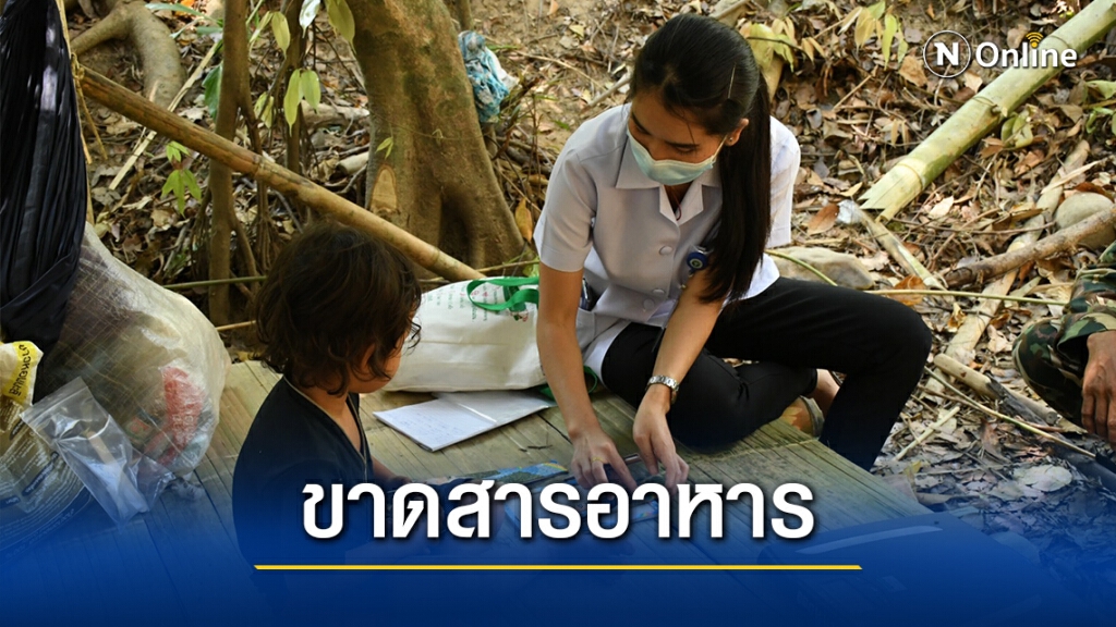 ผลตรวจกลุ่มเด็กบางกลอยบนพบขาดสารอาหาร