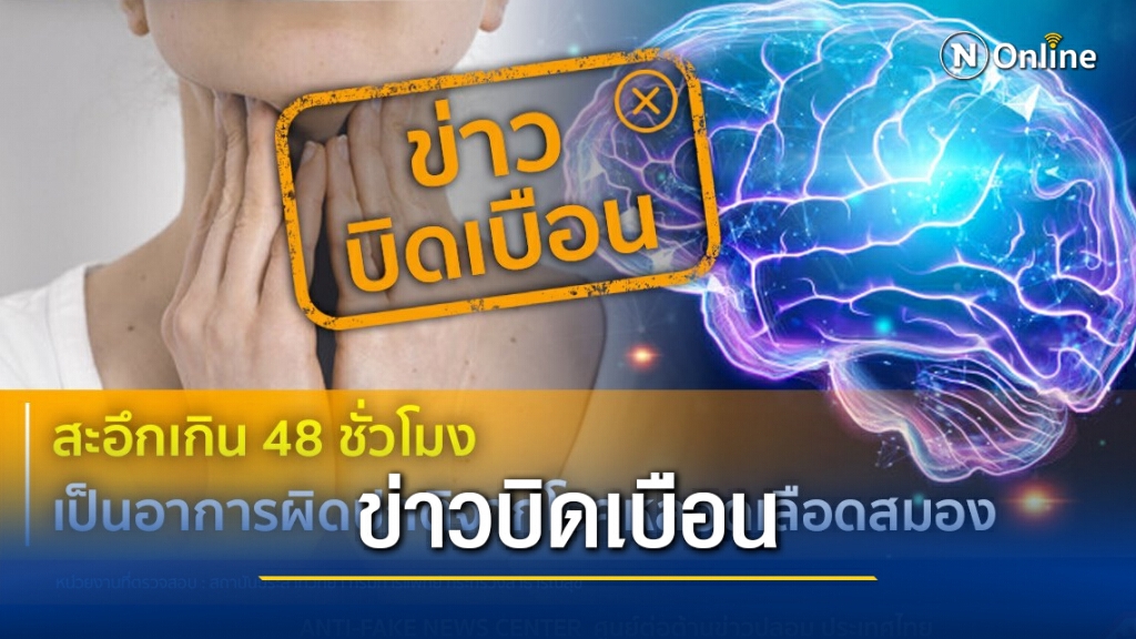 ข่าวบิดเบือน สะอึกเกิน 48 ชั่วโมง เป็นอาการผิดปกติจากโรคหลอดเลือดสมอง