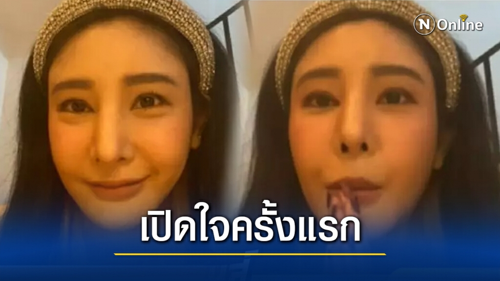 "แตงโม นิดา" เปิดใจครั้งแรก ปมศัลยกรรมทำพิษ พร้อมเผยหน้าล่าสุด