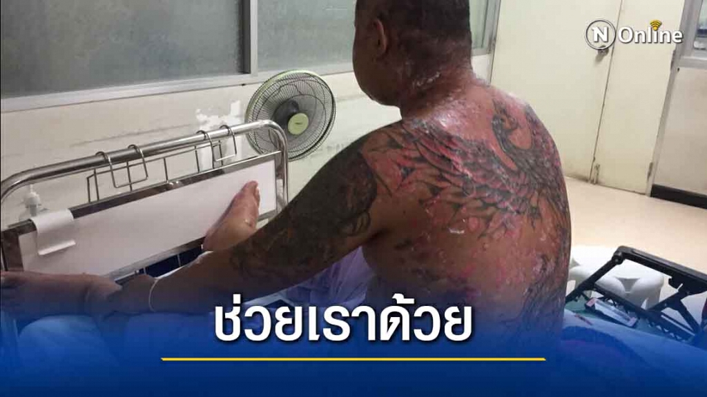 วอนช่วยลูกชายป่วยประหลาดเกิดตุ่มพุพองคล้ายพระเอกดัง