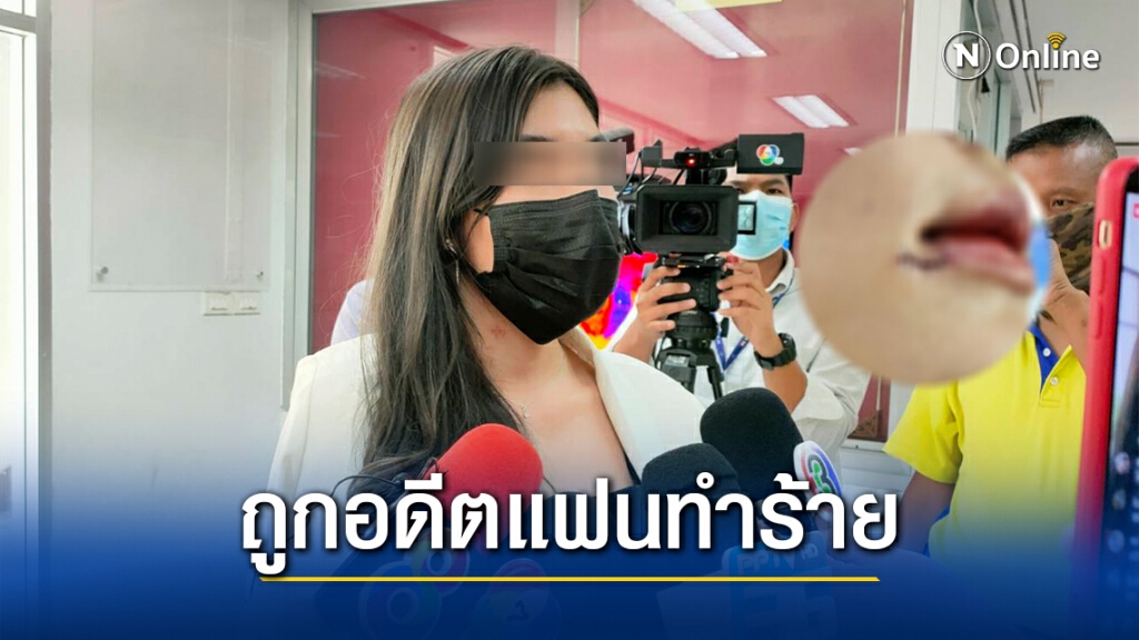 นางแบบสาวเข้าแจ้งความ หลังถูกอดีตแฟน ทำร้ายร่างกาย เย็บ 11 เข็ม!! นางแบบสาวเข้าแจ้งความ หลังถูกอดีตแฟน ทำร้ายร่างกาย เย็บ 11 เข็ม!!