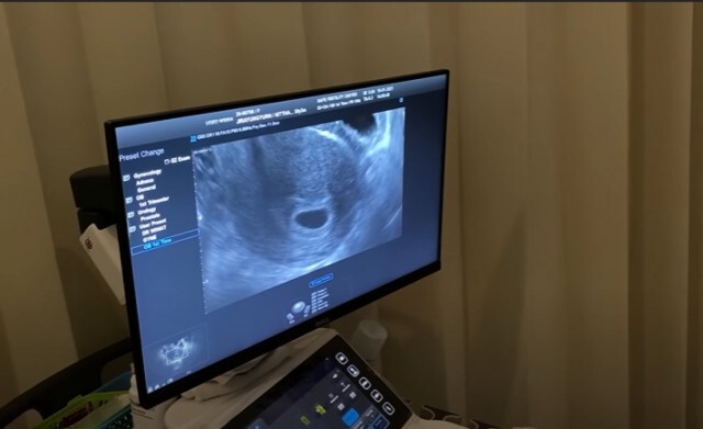 "มิว นิษฐา" เผยข่าวดี ท้องแล้ว!! เพื่อนๆแห่ร่วมยินดี