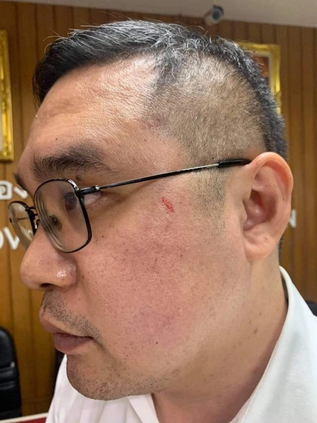 อาจารย์ ม.ราชภัฏราชนครินทร์ แจ้งจับ ส.ส.พลังประชารัฐ ชกหน้า ฐานอยู่ฝ่ายตรงข้าม เลือกตั้งอบจ.