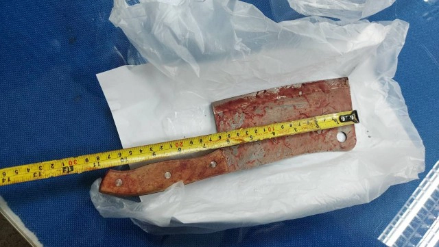 ยกมือไหว้ไม่จบ!-รุมฟันหนุ่มรุ่นน้องดับ