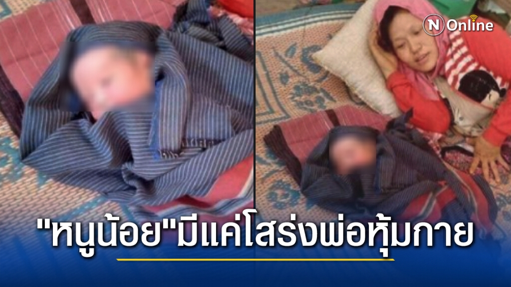 เปิดภาพสุดเศร้า ! ทารกชาวกะเหรี่ยงเกิดใหม่ช่วงภัยสงคราม มีเพียงโสร่งพ่อเท่านั้นที่ใช้ห่อหุ้มร่างกาย เปิดภาพสุดเศร้า ! ทารกชาวกะเหรี่ยงเกิดใหม่ช่วงภัยสงคราม มีเพียงโสร่งพ่อเท่านั้นที่ใช้ห่อหุ้มร่างกาย