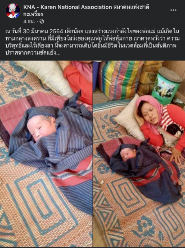 เปิดภาพสุดเศร้า ! ทารกชาวกะเหรี่ยงเกิดใหม่ช่วงภัยสงคราม มีเพียงโสร่งพ่อเท่านั้นที่ใช้ห่อหุ้มร่างกาย