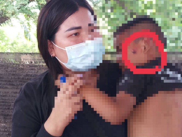 ครูประถมโหด เด็กบวกเลขไม่ได้ใช้ไม้บรรทัดตีหัวเลือดออก
