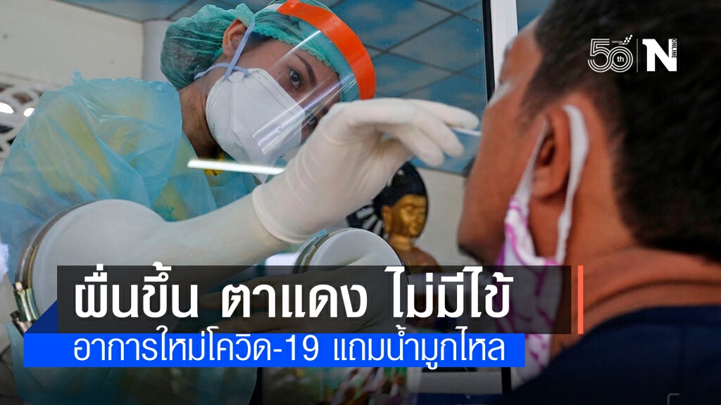 สธ.พบอาการใหม่โควิด-19 ผู้ติดเชื้อจากผับบาร์ ตาแดง-ผื่นขึ้น ไม่มีไข้ เตือนนักเที่ยวรีบพบแพทย์