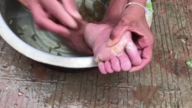 ป้าวอนช่วยเหลือปวดแสบร้อนคล้ายหนอนออกรูขุมขน