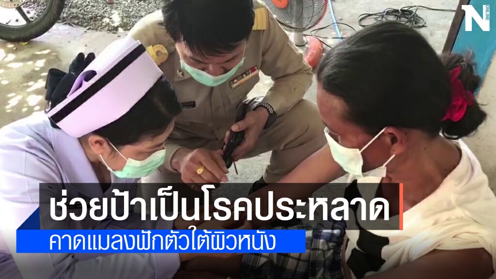 ทีมแพทย์ลงพื้นที่ตรวจสอบป้าป่วยโรคประหลาดมีหนอนออกผิวหนัง ทีมแพทย์ลงพื้นที่ตรวจสอบป้าป่วยโรคประหลาดมีหนอนออกผิวหนัง