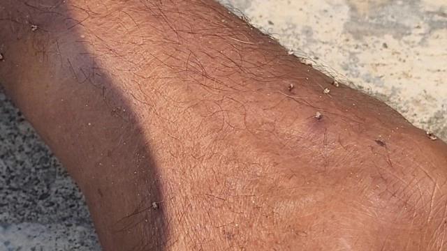 "ผึ้งหลวง"รุมต่อยภารโรงดับคารร.กาวิละ