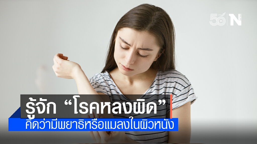 แพทย์ผิวหนังชี้โรคหลงผิดคิดว่ามีพยาธิหรือแมลงในผิวหนัง