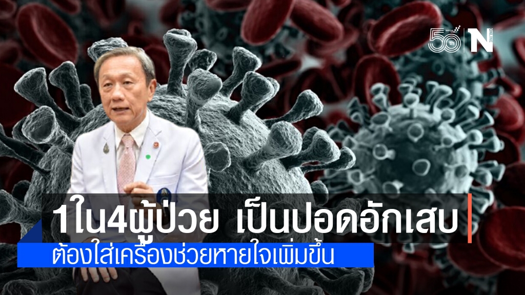 หมอประสิทธิ์เผย 1ใน4 ผู้ป่วยโควิด มีอาการปอดอักเสบ