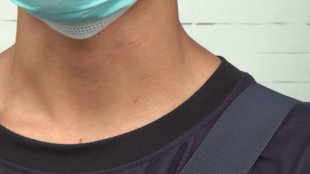 เพื่อนเยาวชนลูกครึ่งให้เบาะแสแก๊งโจ๋รุมทำร้าย