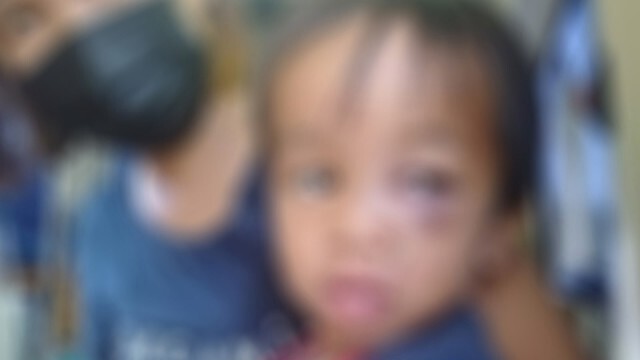 แม่ร้องสื่อพ่อเลี้ยงโหดตีลูกชาย2ขวบเจ็บสาหัส