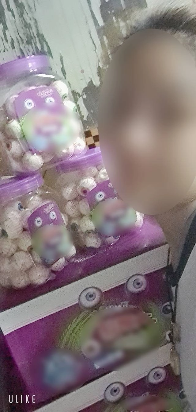 กินเยลลี่ลูกตาแล้วป่วยเอง สาวรีวิวด่าเด็กๆ ถ้าอ่อนแอก็แพ้ไป