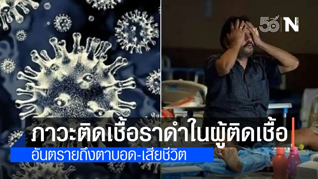 อินเดียพบเชื้อราดำในผู้ป่วยโควิด-19 รวม 50 ราย เสี่ยงตาบอด-เสียชีวิต