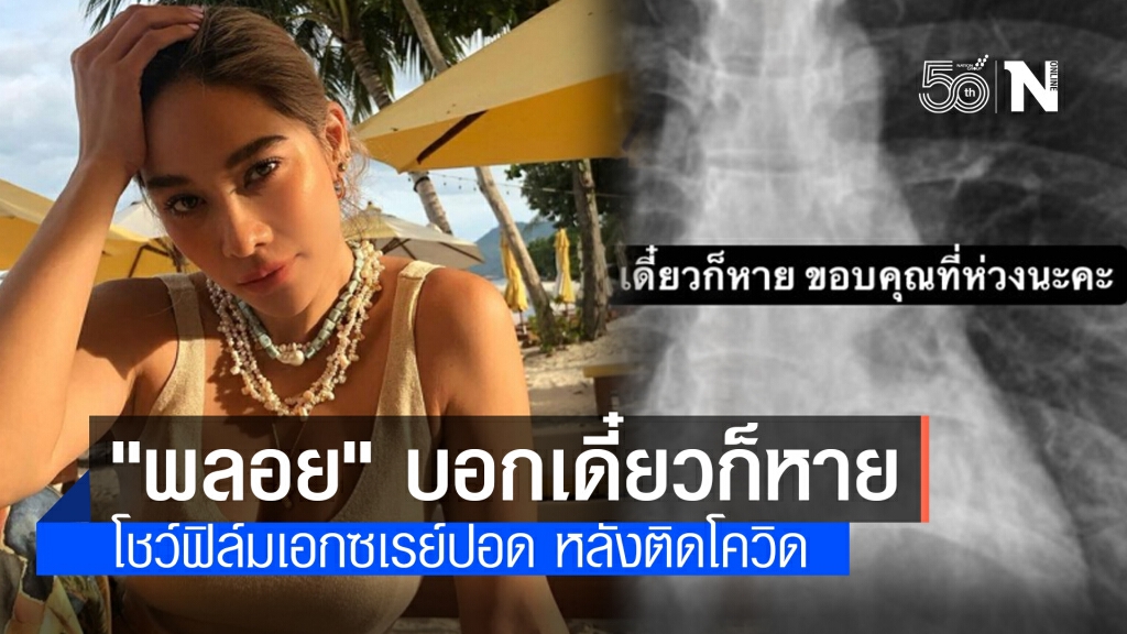 "พลอย" โพสต์ภาพเอกซเรย์ปอด บอกติดโควิดเดี๋ยวก็หาย "พลอย" โพสต์ภาพเอกซเรย์ปอด บอกติดโควิดเดี๋ยวก็หาย