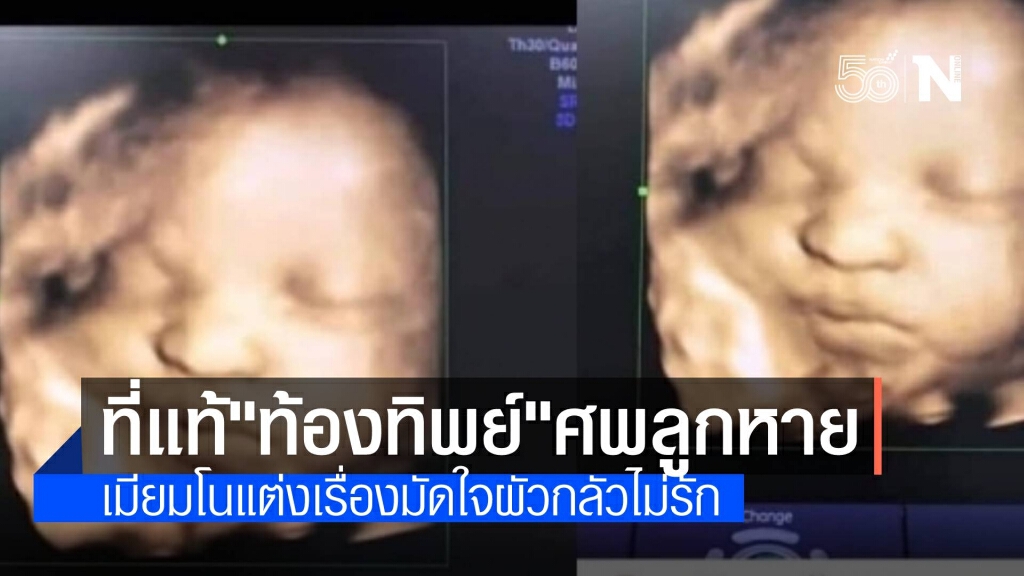 ผัวสารภาพเมีย "ท้องทิพย์" แต่งเรื่องศพลูกแฝดหาย ผัวสารภาพเมีย "ท้องทิพย์" แต่งเรื่องศพลูกแฝดหาย